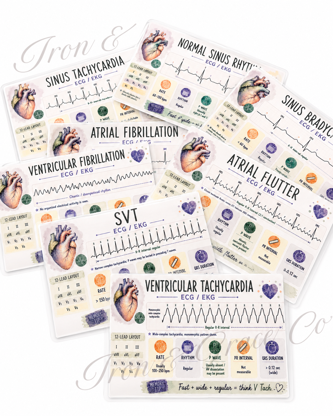 ECG/EKG Rhythm Study Cards | Nursing & Paramedic Student Flashcards | PDF Download 5" x 3"